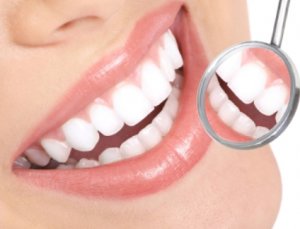 Как не навредить зубной эмали во время отбеливания