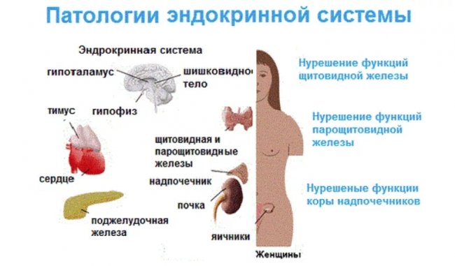 Заболевание женской эндокринной системы